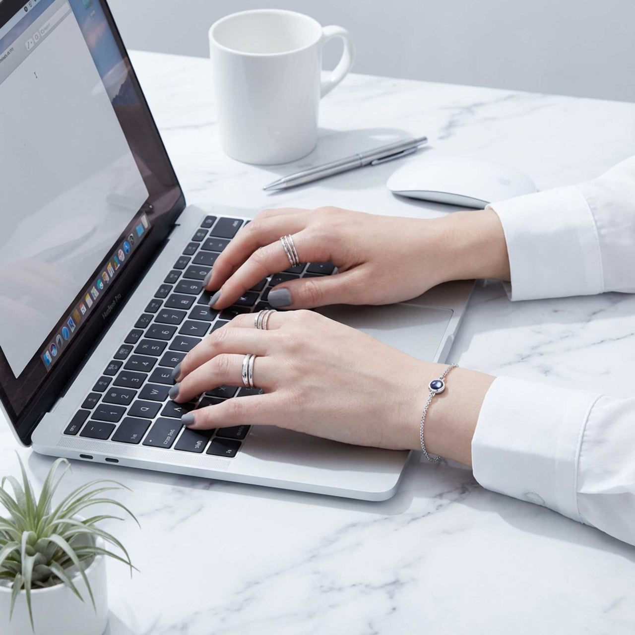 Erinnerungs-Armband Baby | Vom Ultraschall bis Heute